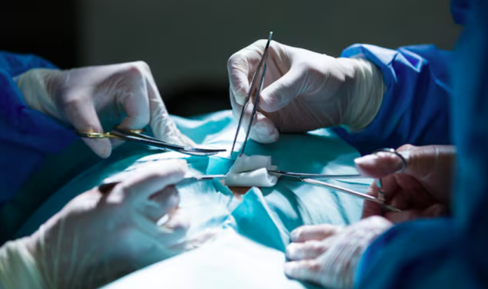 Hemorrhoidectomy